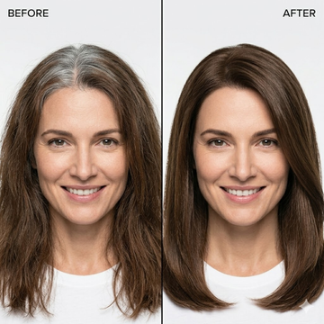 Proskire Grey Hair Solution Serum – Restores Natural Hair Appearance – Stimulates Hair Pigment Cells – Reduces Grey Hair, Supports Natural Pigment, Strengthens Hair Roots